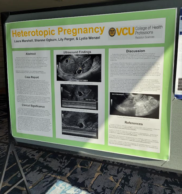 Heterotopic Pregnancy by Laura Marshall, Sharese Ogburn, Lily Perger & Lydia Wenzel