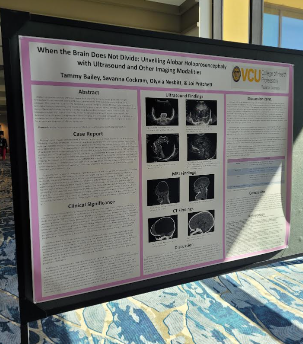 When the Brain Does not Divide: Unveiling Alobar Holoprosencephaly with Ultrasound and Other Imaging Modalities by Tammy Bailey, Savanna Cockram, Olyvia Nesbitt, and Joi Pritchett